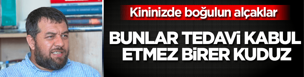 Bunlar tedavi kabul etmez birer kuduz