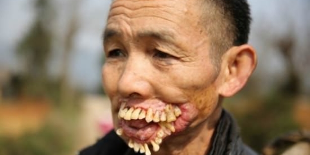 Dünyanın en tuhaf hastalıkları