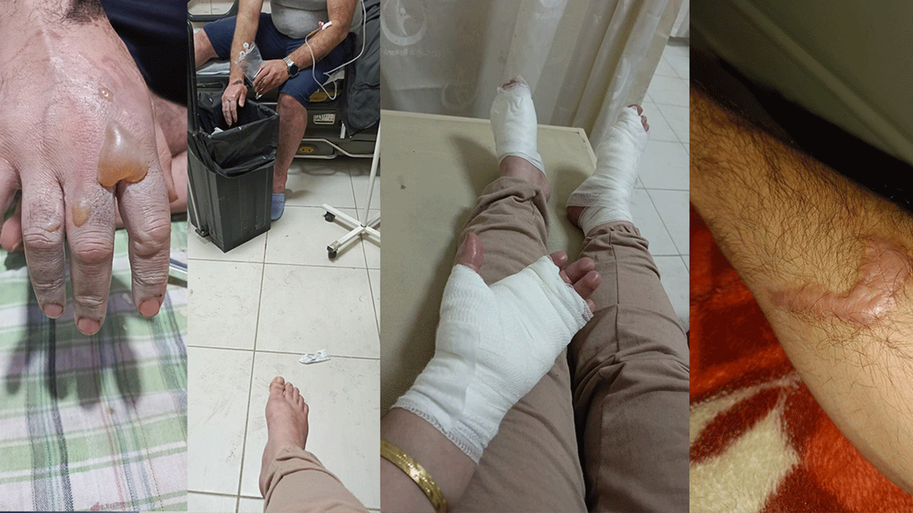 Bunu yaparken dikkat edin! Lavabo açıcı bomba gibi patladı!