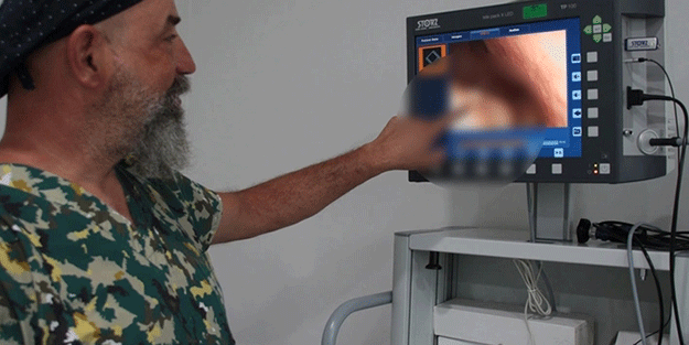 Burnunuzda bu oluyorsa aman dikkat! 3 kişiden 2’sinde görülüyor