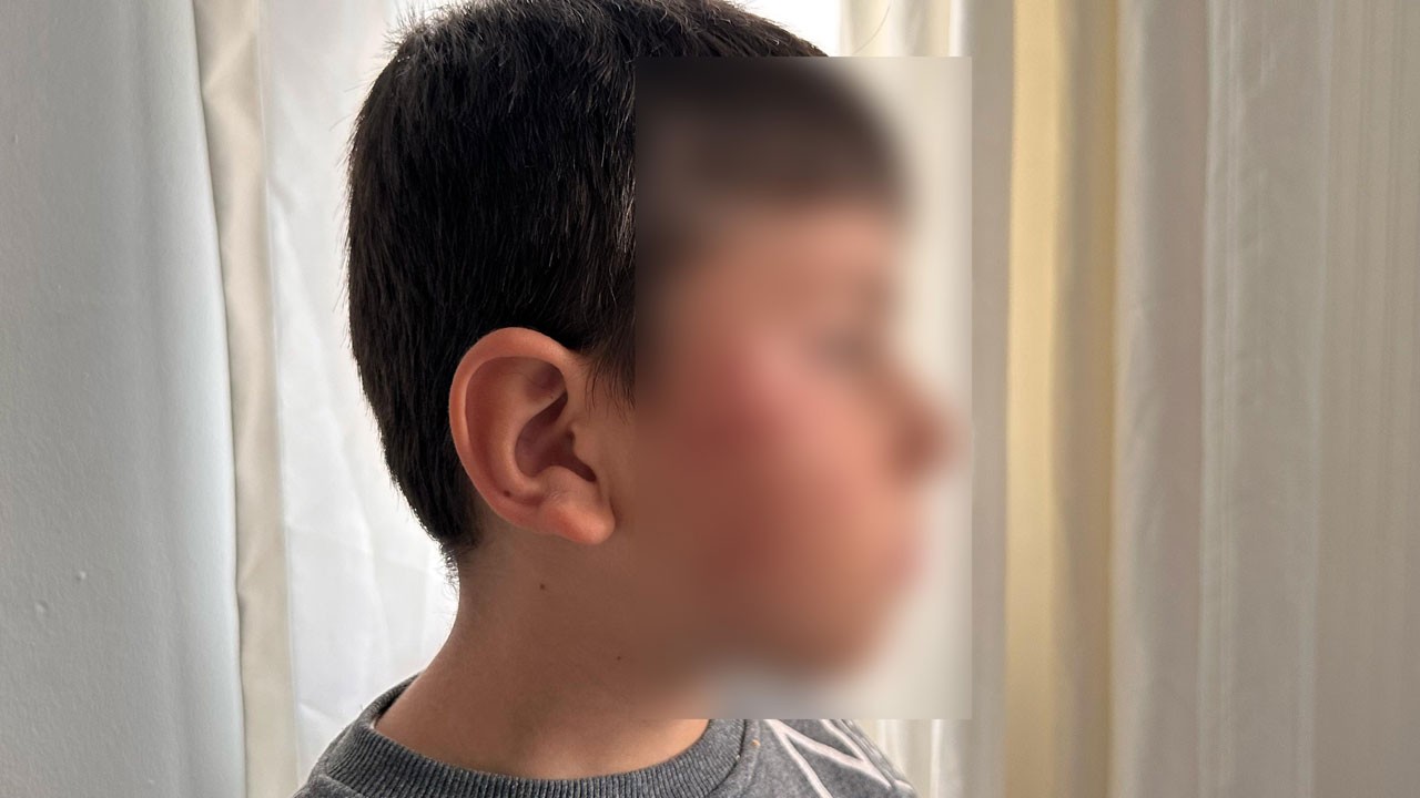 Bursa’da anne dehşeti: Oğluyla kavga eden 6 yaşındaki öğrenciyi okulda dövdü