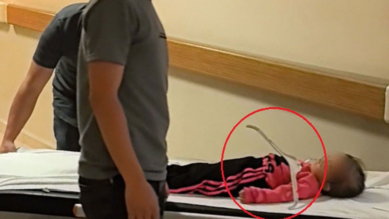 Bursa’da dehşet anları! Askı çenesine saplandı