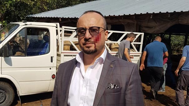 Bursa’da icraya giden avukatın yanağını ısırarak kopardı