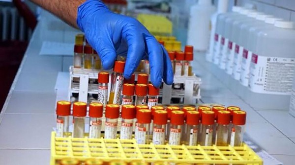 Burun akıntısı korona belirtisi mi? Burnum akıyor korona olabilir miyim?