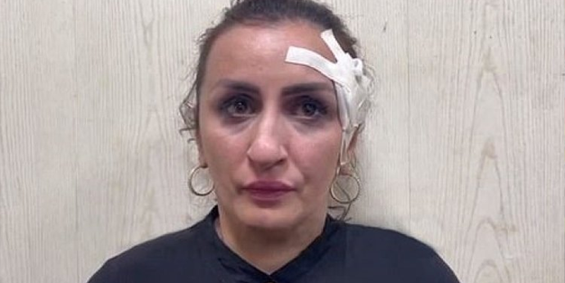 Burun estetiği için 5 günlük bebeğini satan kadın tutuklandı!