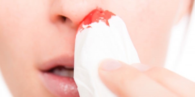 Burun kanamalarına uzman yorumu! Hafife alınmayacak hastalıkların belirtisi olabilir