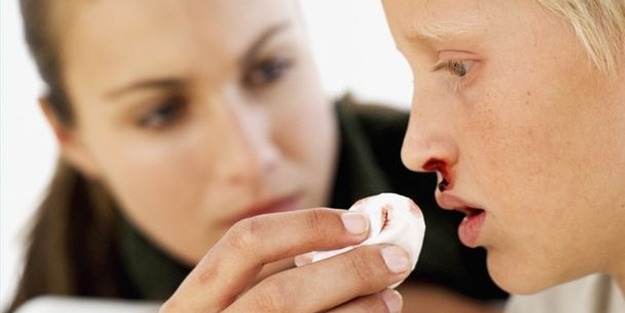 Burun kanamasının türleri nelerdir?