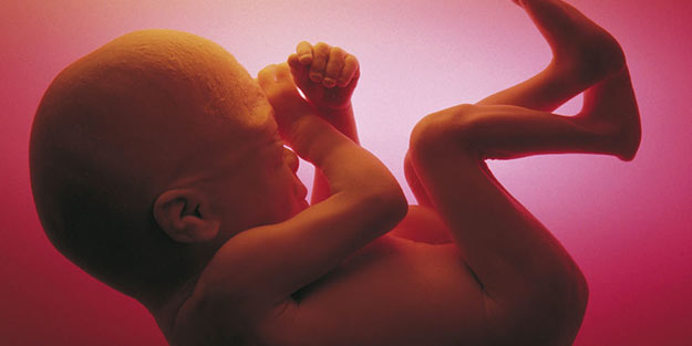 Büyük buluş! Down sendromu anne karnında tedavi edilebilecek