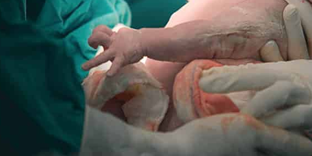 Büyük facia! Doktor doğumda bebeğin kafasını kopardı!