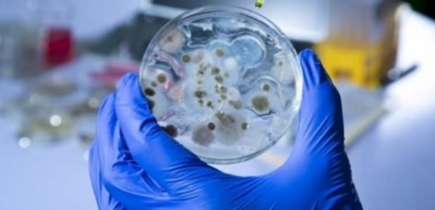 Yanlışlıkla canlı şarbon bakterileri göndermişler