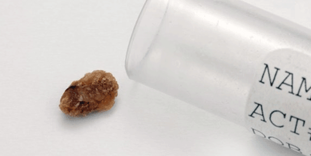 Büyük tehlike! Yavaşça ortaya çıkıyor, dayanılmaz ağrılar ve ölüm...