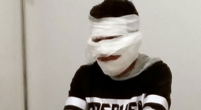 Çakmak tüpüyle torpil patlatan çocuk yandı