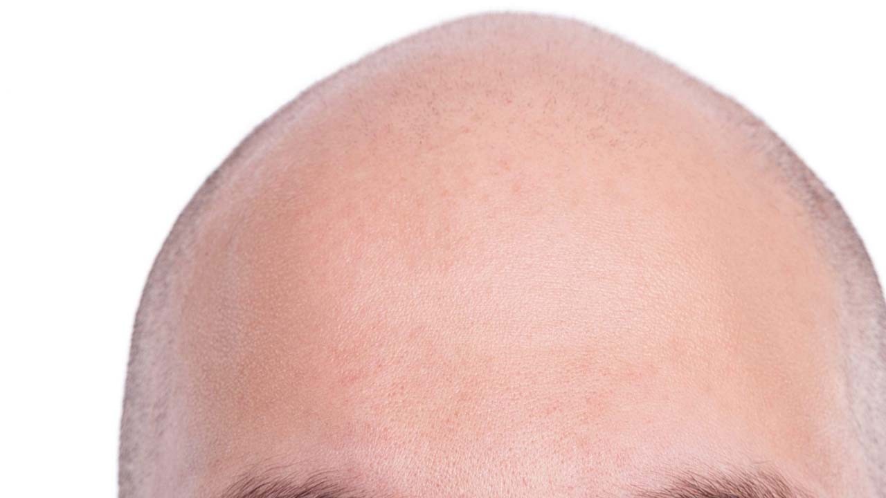 Canan Karatay tavsiyesi: Saçları oluk oluk döküyor: Ağzınıza bile sürmeyin, kelliğe neden oluyor!