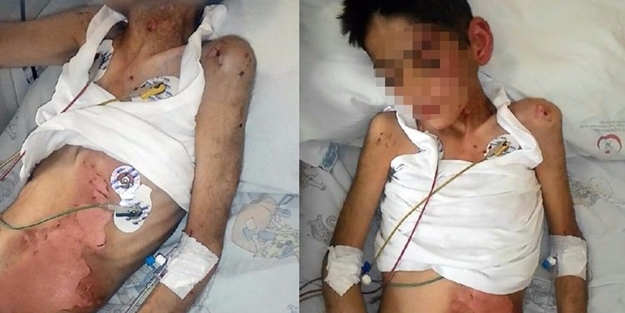 Cani anne kocasına benzediği için çocuğunu bu hale soktu!