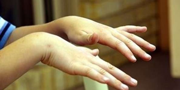 Çatlayan elleri poşette yumuşatın