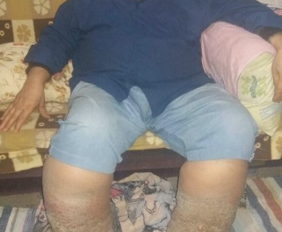 6 çocuk babası çaresiz... Yardım bekliyor!