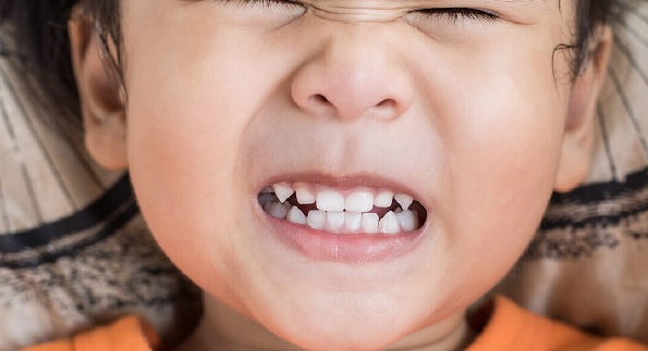 Çene eklemi problemleri can sıkıcı olabiliyor | Diş gıcırdatma sorunlarının sebebi bu!