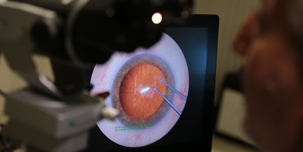 Cerrahi simülasyon eğitimi göz ameliyatlarındaki başarıyı artırıyor