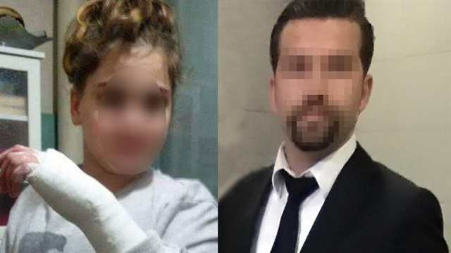 Cetvelle öğrencisinin elini kıran öğretmene 3 bin lira ceza