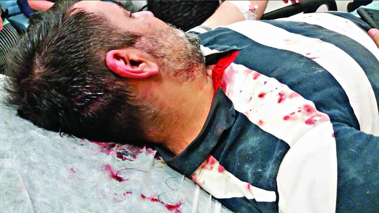 CHP yolsuzluğunu yazdım kazma kürekle dövdüler!
