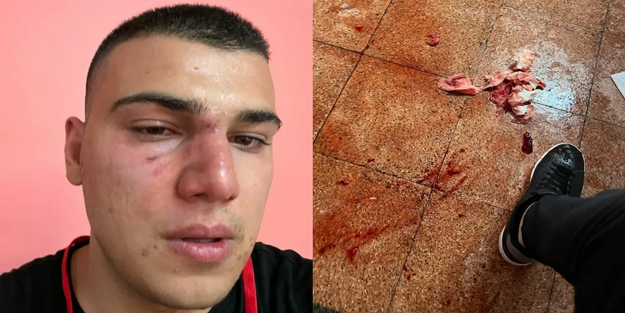 CHP'de 'değişim' isteyenin resmen ağzını burnunu kırıyorlar!