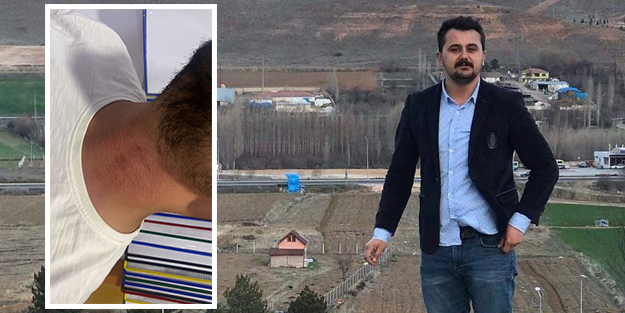 CHP'de ortalık karıştı! Gençlik Kolları Başkanı'na dayak