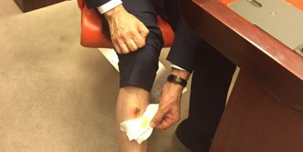 CHP'li vekil ısırdı, AK Partili vekil aşı oldu