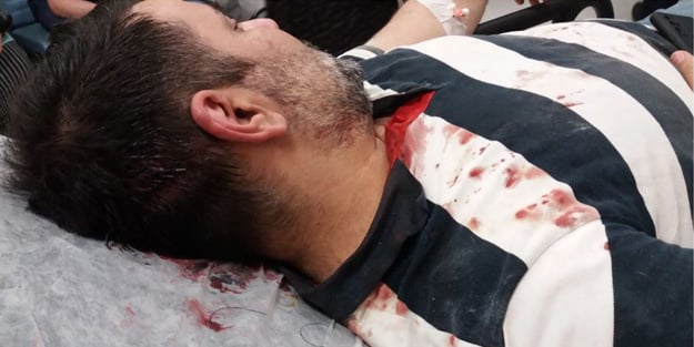 CHP'li Adalar Belediyesi'nin yolsuzluklarını ifşa eden gazeteciye kazma kürekli saldırı!