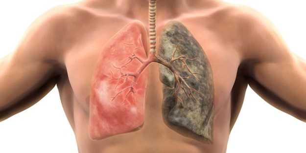 Ciğerleri bir haftada tamamen temizliyor! İşte nikotini dışarı atan süper besinler...