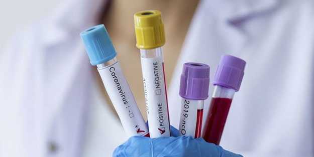 Çılgın koronavirüs iddiası: Bazı şarkılar bulaşıcılığı arttırıyor