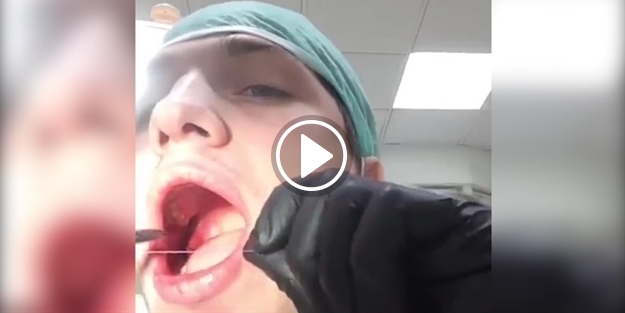 Çılgın Rus dişçi kendi işini kendi görüyor!