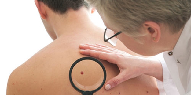 Cilt kanseri nasıl tedavi edilir?