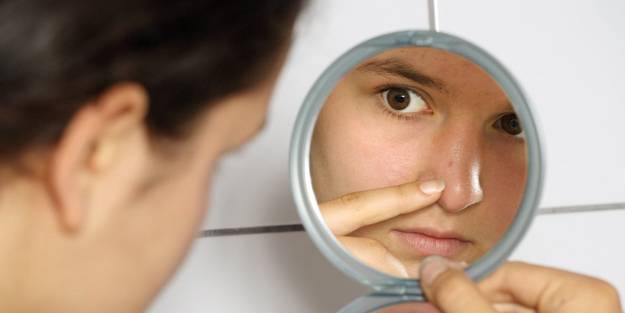 Ciltte siyah nokta oluşumunu engelleyecek 5 madde!