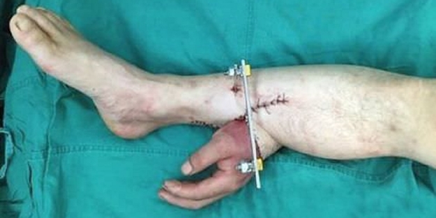 Çin işi ameliyat - FOTO