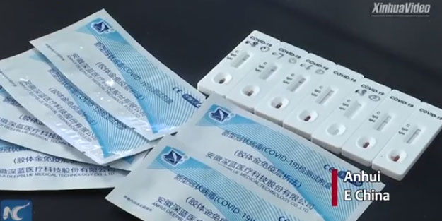 Çin koronavirüs ile ilgili bomba gelişmeyi duyurdu: 15 dakikada sonuç veriyor