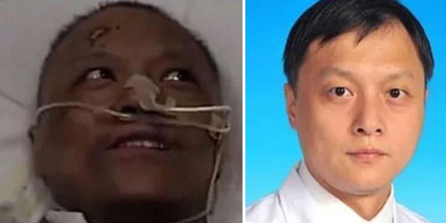 Çin’de koronavirüsü yenen doktorların ten rengi değişti