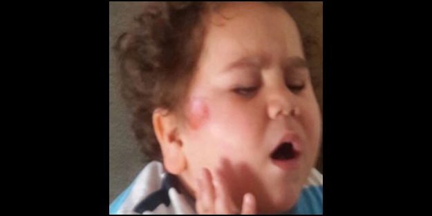 'Çitos Efe'ye nazar değdi! Trafik kazası geçirdi