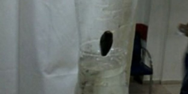 Çocuğun boğazından öyle bir şey çıktı ki...