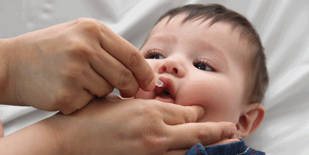 Çocuk felci nasıl tedavi edilir?