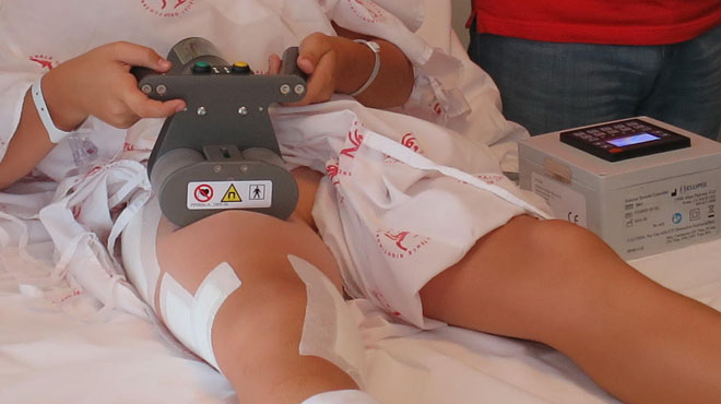 Çocuklarda bacak kısalıklarına kumandalı tedavi