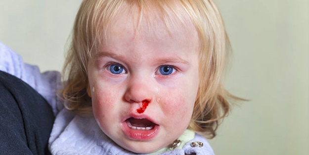 Çocuklarda burun kanamalarının nedenleri