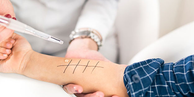 Çocuklarda yaz alerjisini tetikleyen 8 hata! Her 3 çocuktan biri bu yüzden alerji oluyor