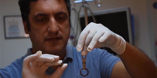 Çocukların midesinden öyle şeyler çıktı ki!