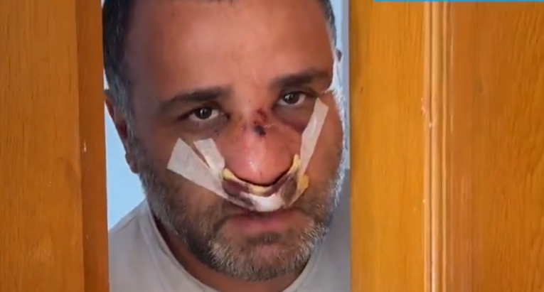 Çocuklarının gözleri önünde darp edildi! Baba isyan etti: “Psikolojileri mahvoldu”