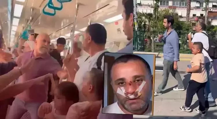 Çocuklarının gözü önünde burnunu kırmıştı! Saldırgan yırtmak için bakın ne atıp tuttu