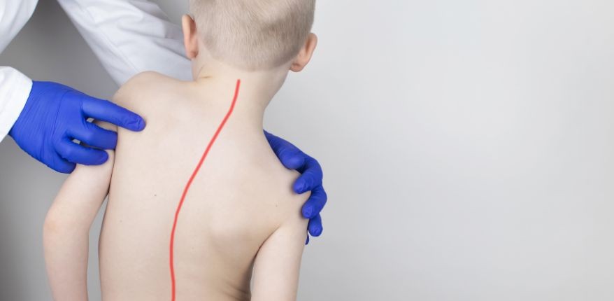 Çocuklarınızın omuz hizasında fark varsa dikkat!