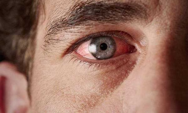 Çoğu kişi bu belirtileri önemsemiyor! Bu hata gözlerinizi kaybettirebilir