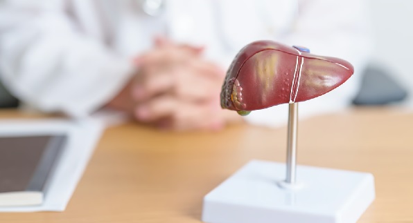 Çoğu kişi önemsemiyor ama... Karaciğer yağlanması bakın neye sebep oluyor