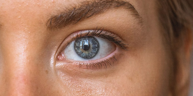 Çok fena siyah noktaları pul pul döküp ilk kez temizliyor! Önce ve sonra şaşkına çeviren yeni görüntü!