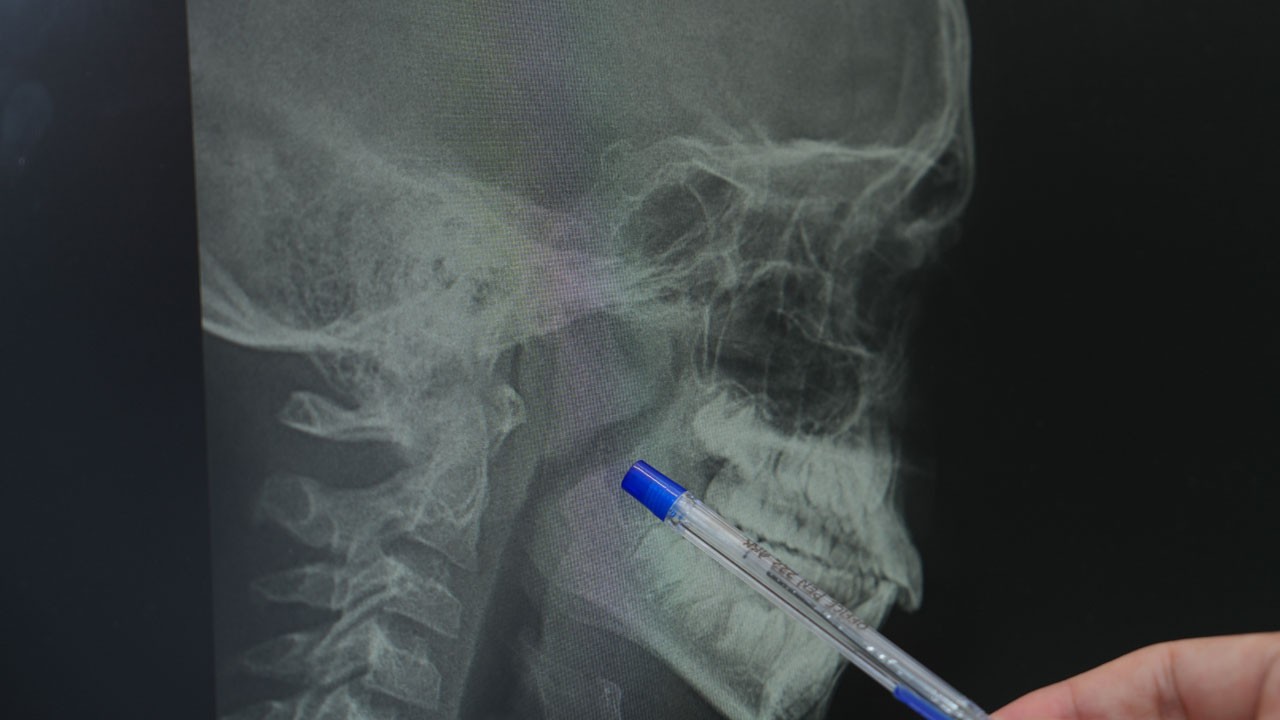 Çok tehlikeli sonuçlara yol açıyor! Horlama aslında bir yardım çağrısı